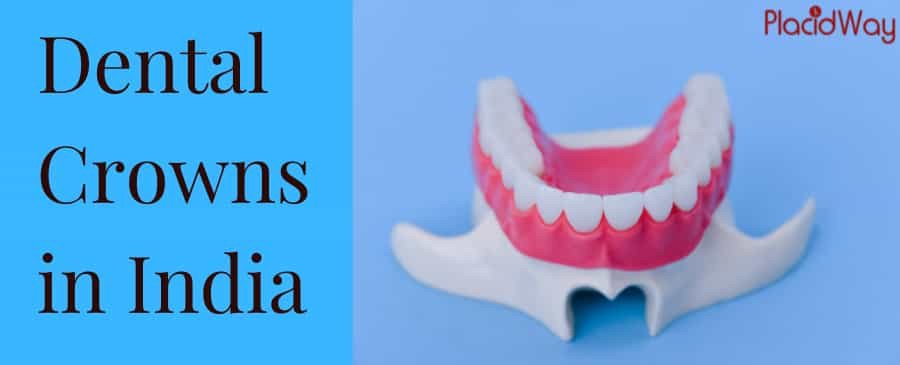 Dental Crowns in India - Quality Dental Work