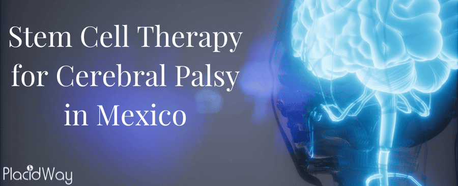 Stem Cell Therapy for Cerebral Palsy in Mexico