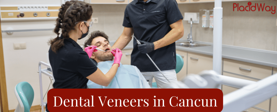 Dental Veneers in Cancun, Mexico