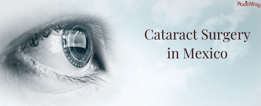 Cataract Surgery in Mexico