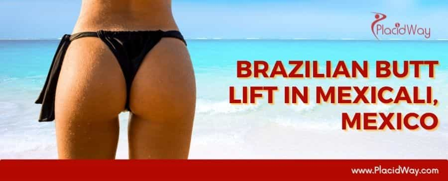 Brazilian Butt Lift in Mexicali, Mexico