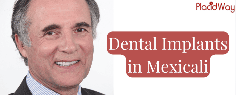 Dental Implants in Mexicali, Package, Cost, Clinics, Reviews