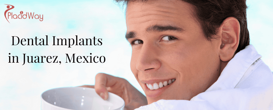 Dental Implants in Juarez