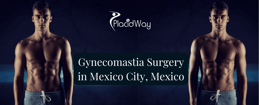 Gynecomastia Surgery in Mexico City, Mexico