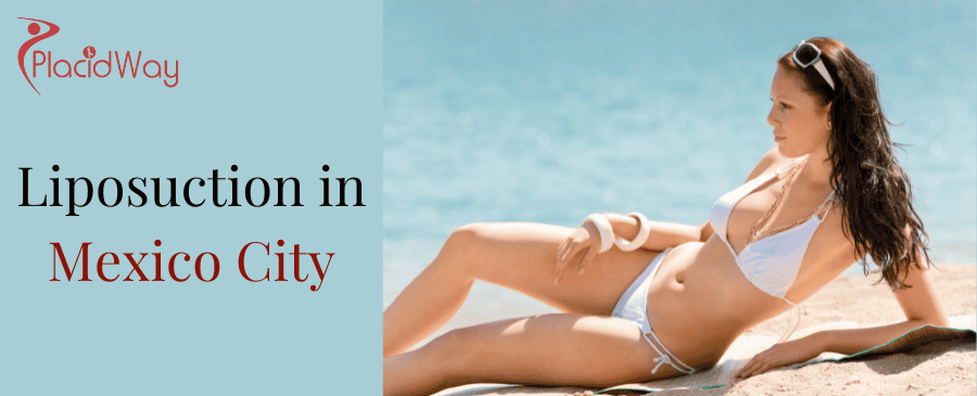 Liposuction in Mexico City