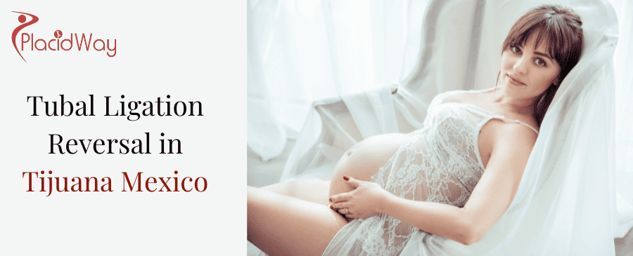 Tubal Ligation Reversal in Tijuana Mexico