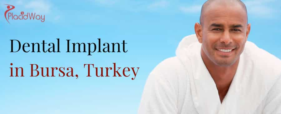 Dental Implant in Bursa, Turkey