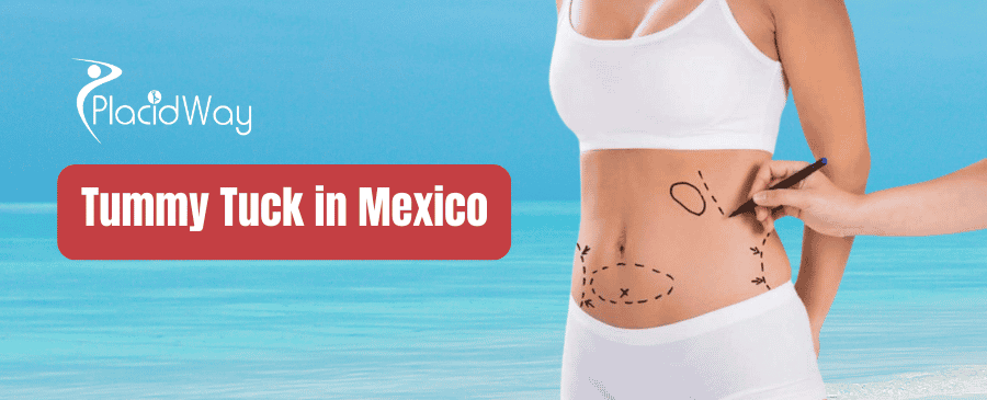 Tummy Tuck in Mexico