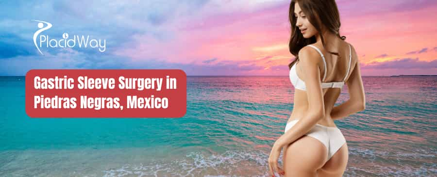 Gastric Sleeve Surgery in Piedras Negras, Mexico