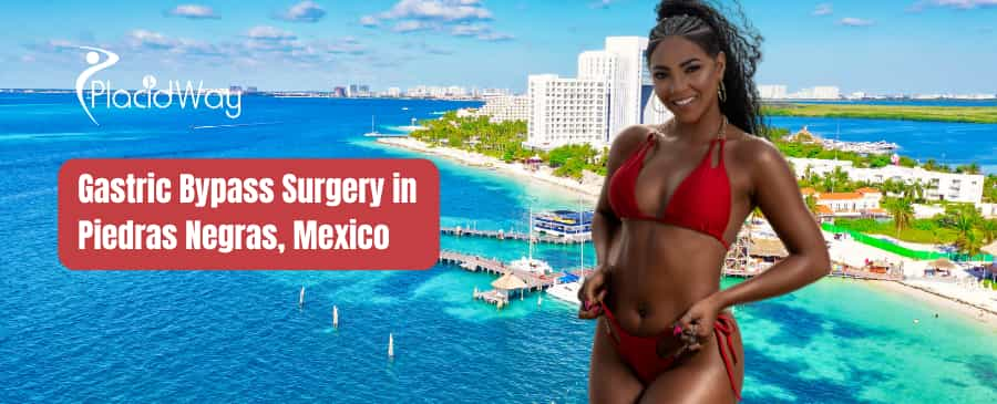 Gastric Bypass Surgery in Piedras Negras, Mexico