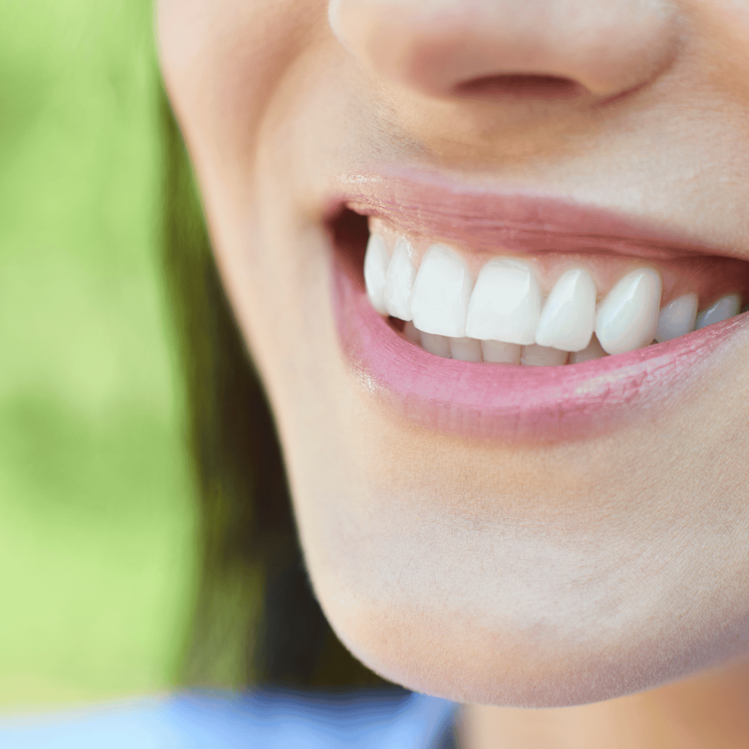 Things to Know About Dental Implants in Mumbai, India