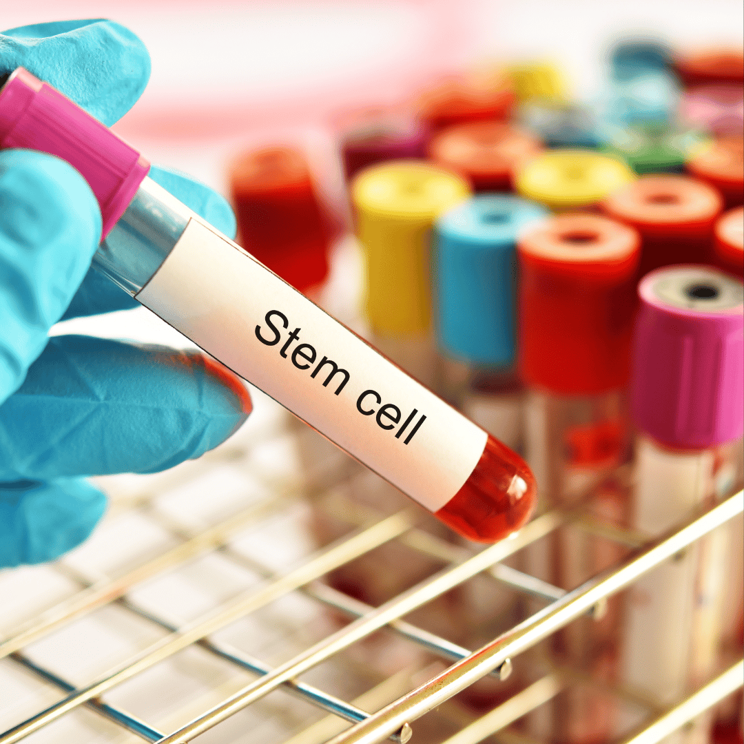 European Patients Seek Stem Cell Solutions for Orthopedic Conditions in the Czech Republic