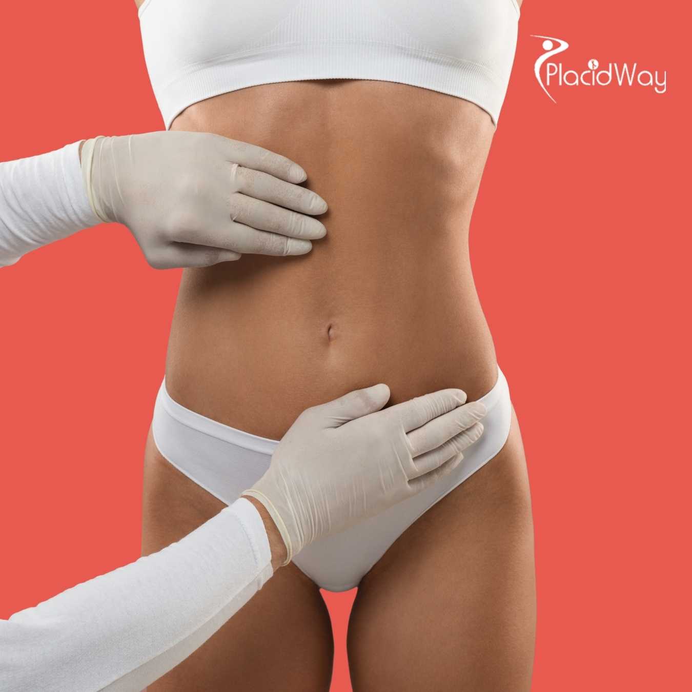 Tummy Tuck in South Korea