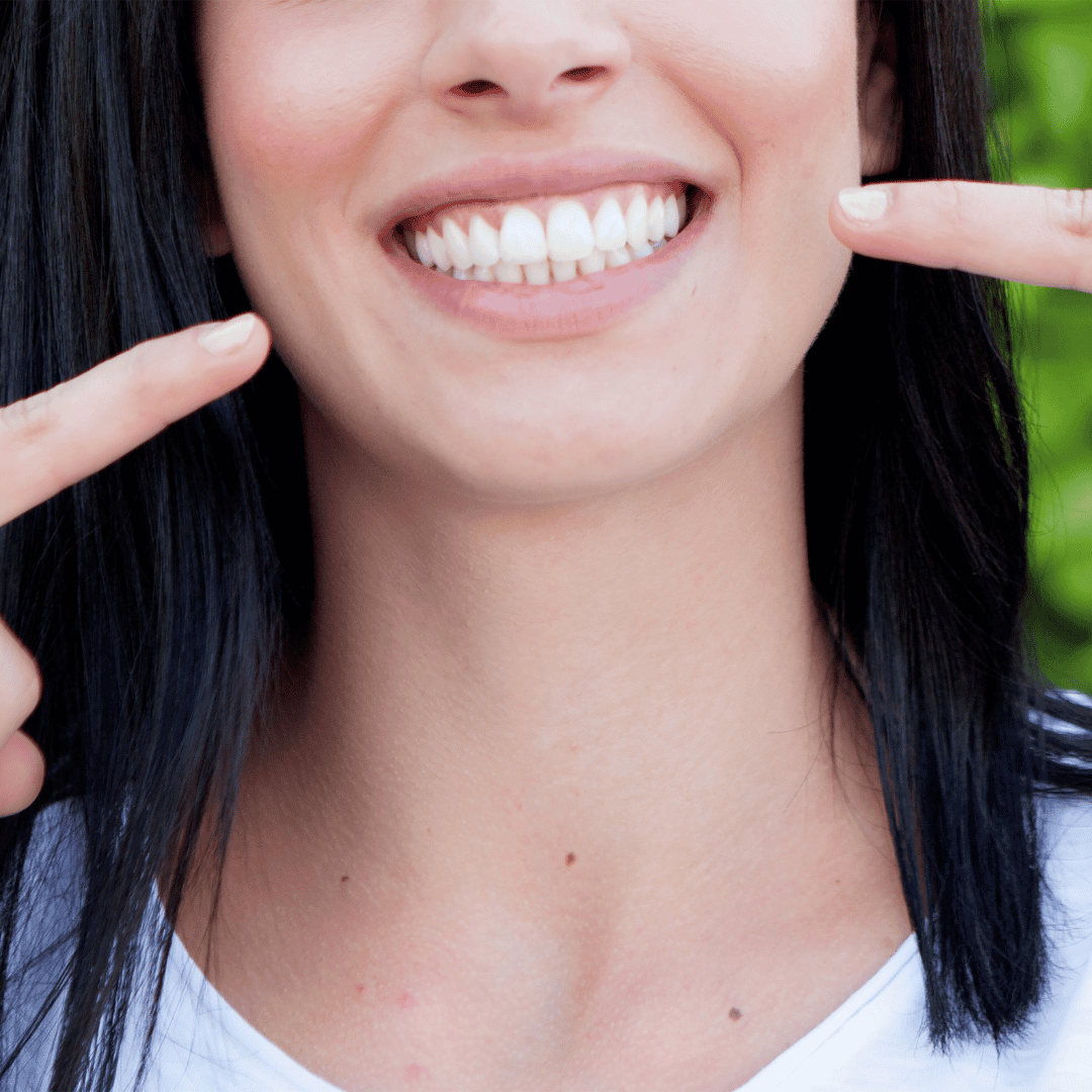 Best Package for Dental Veneers in Croatia