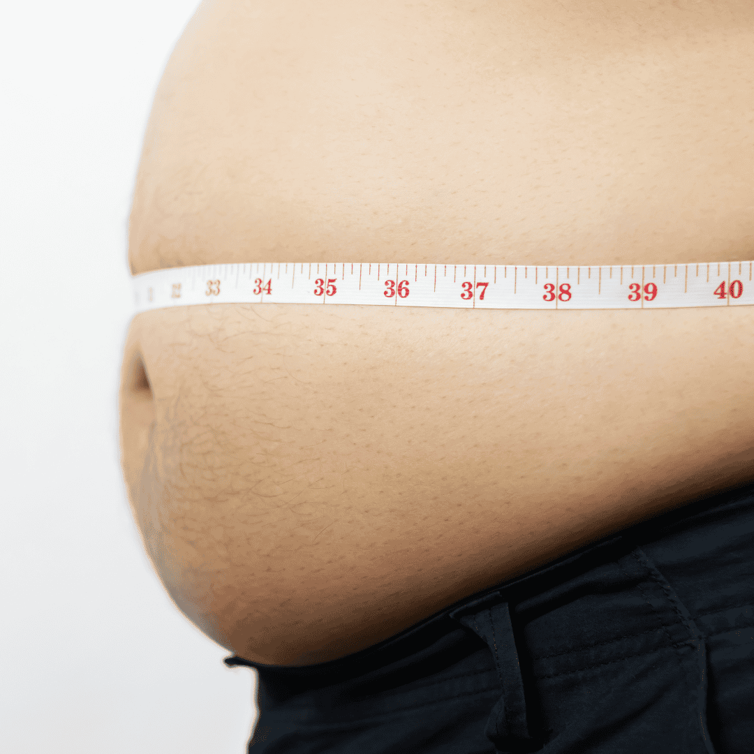 Gastric Bypass Package in Merida, Mexico by Hernia Clinic