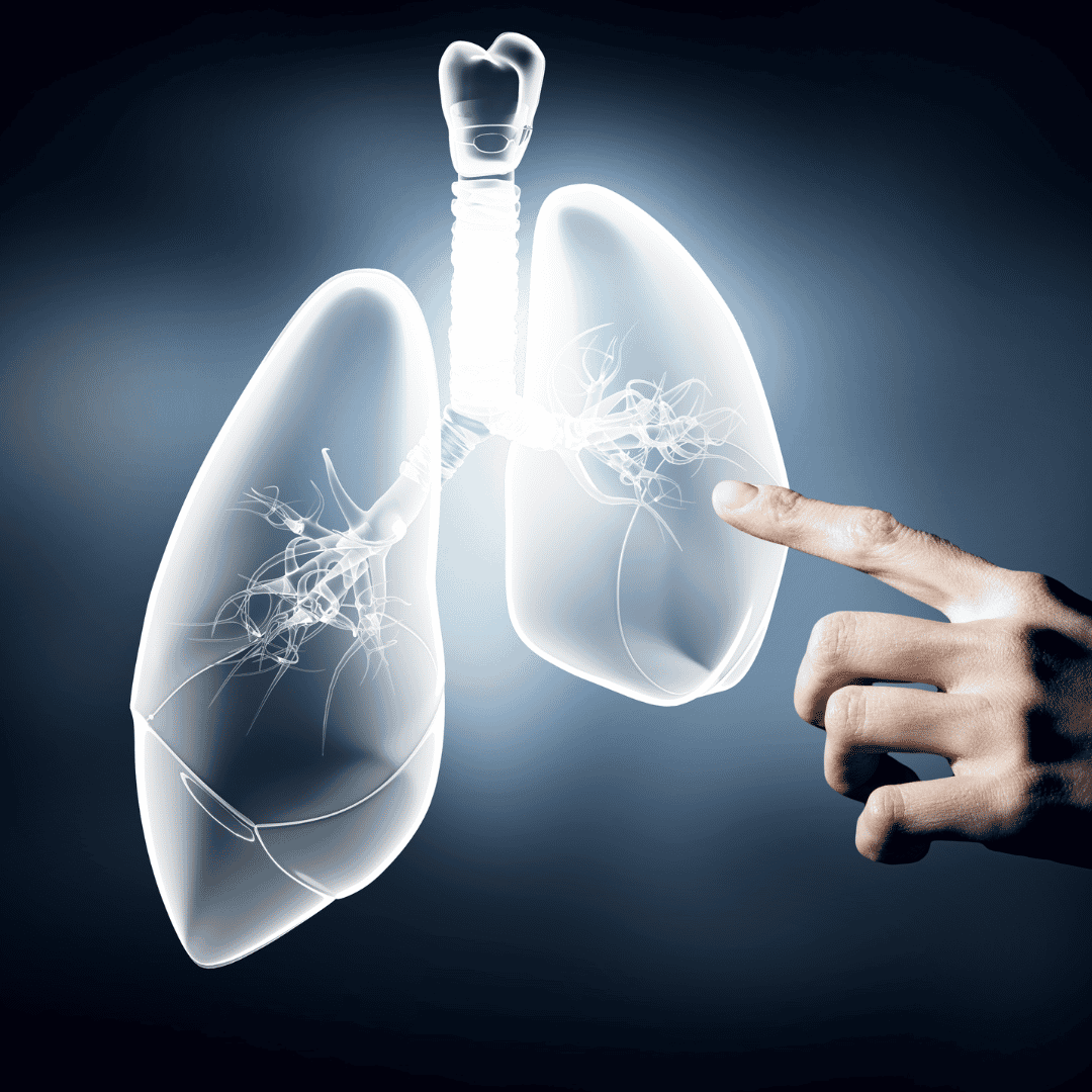 Affordable Packages for Stem Cell Therapy for COPD in Plantation, Florida