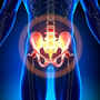 Best Package for Hip Replacement in Tijuana, Mexico thumbnail