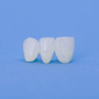 Popular Package for Dental Crowns in Istanbul, Turkey thumbnail