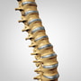 Best Spine Care Surgery in Tijuana, Mexico thumbnail