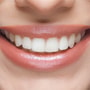 All on 4 Dental Implants Package in Cancun, Mexico by YeahSmile thumbnail